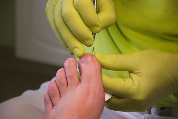 foot-care-3557103_960_720